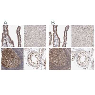 Immunohistochemistry-Paraffin: MSH6 Antibody [NBP1-83319]