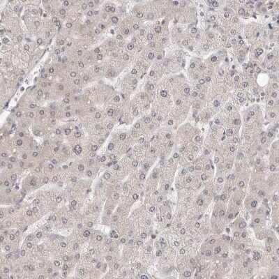 Immunohistochemistry-Paraffin: MSH6 Antibody [NBP1-83319]