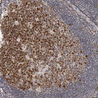 Immunohistochemistry-Paraffin: MSH6 Antibody [NBP1-83319]
