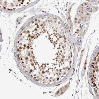 Immunohistochemistry-Paraffin: MSH6 Antibody [NBP1-83319]