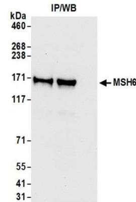 Immunoprecipitation: MSH6 Antibody (BLR117H) [NBP3-14703]