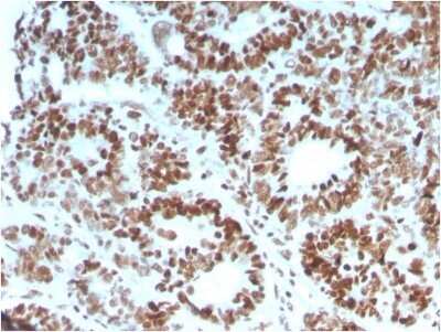 Immunohistochemistry-Paraffin: MSH6 Antibody (MSH6/3086) - Azide and BSA Free [NBP2-79846]