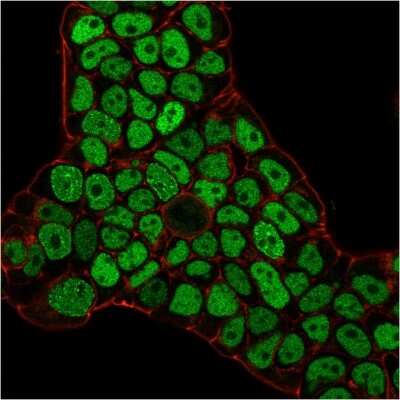 Immunocytochemistry/ Immunofluorescence: MSH6 Antibody (MSH6/3086) [NBP2-79712]