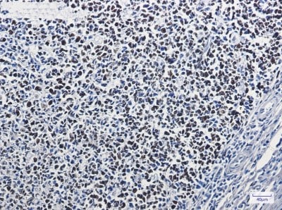 Immunohistochemistry-Paraffin: MSH6 Antibody (S05-2B5) [NBP3-19526]
