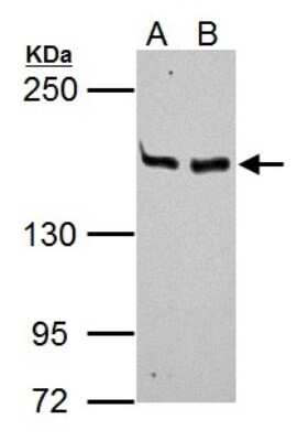 Western Blot: MSH6 Antibody [NBP1-33151]