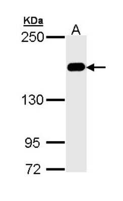 Western Blot: MSH6 Antibody [NBP1-33151]