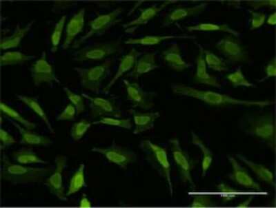 Immunocytochemistry/ Immunofluorescence: MSK1/RPS6KA5 Antibody (2B11) [H00009252-M01]