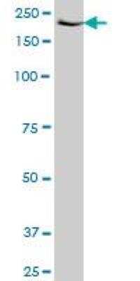 Western Blot: MSK1/RPS6KA5 Antibody (2B11) [H00009252-M01]