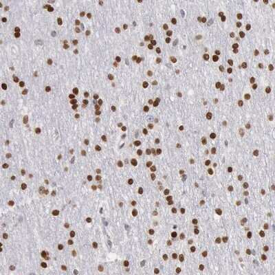 Immunohistochemistry-Paraffin: MSK1/RPS6KA5 Antibody [NBP1-82618]