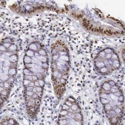 Immunohistochemistry-Paraffin: MSK1/RPS6KA5 Antibody [NBP1-82618]