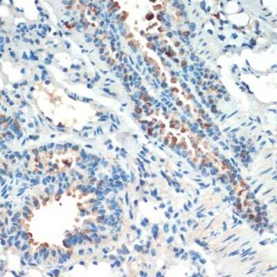 Immunohistochemistry-Paraffin: MSK2 Antibody - Azide and BSA Free [NBP2-93168]