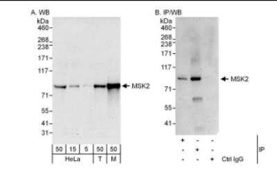 Immunoprecipitation: MSK2 Antibody [NBP1-46187]