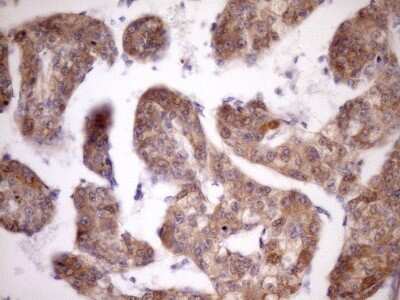 Immunohistochemistry-Paraffin: MSP/MST1 Antibody (OTI1A10) [NBP2-46024]