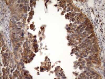 Immunohistochemistry: MSP/MST1 Antibody (OTI1A10) - Azide and BSA Free [NBP2-72792]