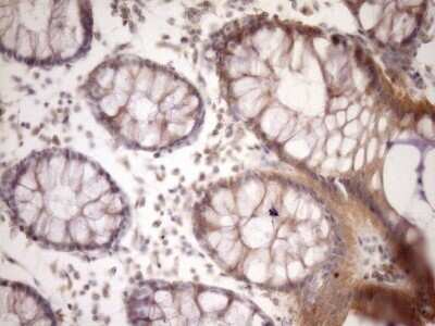 Immunohistochemistry: MSP/MST1 Antibody (OTI1A10) - Azide and BSA Free [NBP2-72792]