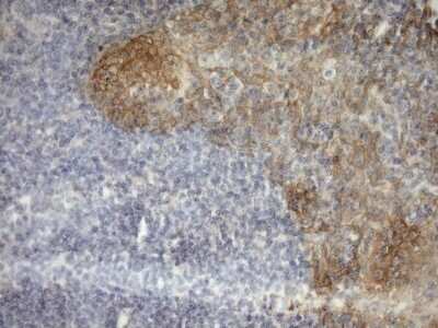Immunohistochemistry: MSP/MST1 Antibody (OTI1A10) - Azide and BSA Free [NBP2-72792]