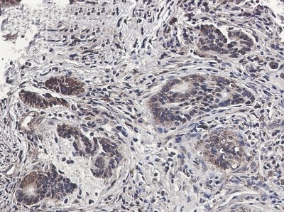 Immunohistochemistry-Paraffin: MSP/MST1 Antibody (S04-1D6) [NBP3-19812]