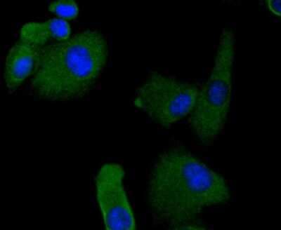 Immunocytochemistry/ Immunofluorescence: MSPR/Ron Antibody (SD2006) [NBP2-67814]