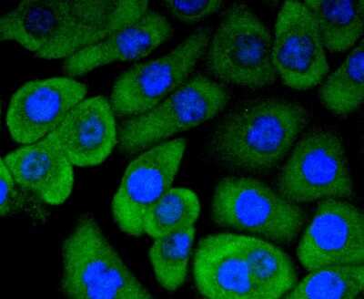 Immunocytochemistry/ Immunofluorescence: MSPR/Ron Antibody (SD2006) [NBP2-67814]