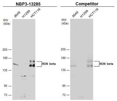 Western Blot: MSPR/Ron Beta Antibody [NBP3-13285]