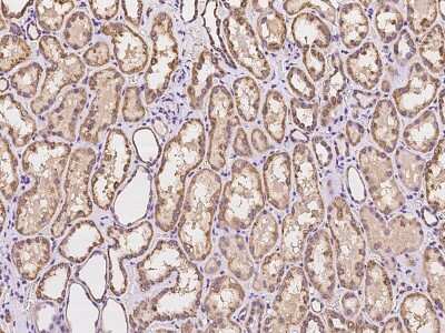Immunohistochemistry-Paraffin: MSRB2 Antibody [NBP2-97958]