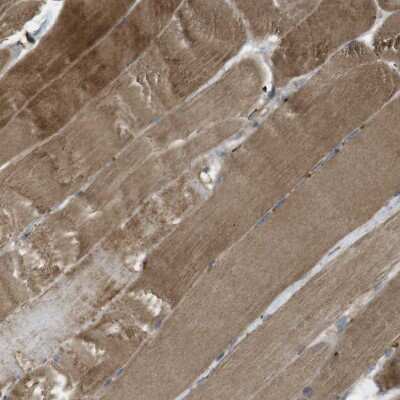 Immunohistochemistry-Paraffin: MSRB3 Antibody [NBP1-84259]