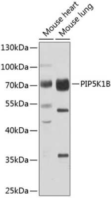 Western Blot: MSS4 AntibodyBSA Free [NBP2-93502]