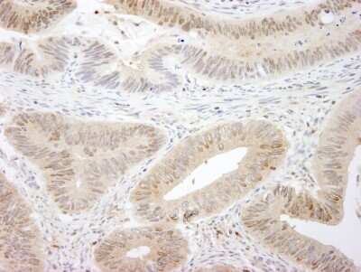 Immunohistochemistry-Paraffin: MST1/2 Antibody [NBP1-28672]
