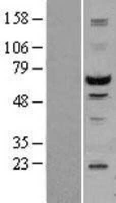 Western Blot: MST2/STK3 Overexpression Lysate [NBL1-16546]