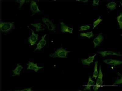 Immunocytochemistry/ Immunofluorescence: MST2/STK3 Antibody (4F7) [H00006788-M13]