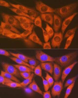 Immunocytochemistry/ Immunofluorescence: MST2/STK3 Antibody (5J1I4) [NBP3-16737]