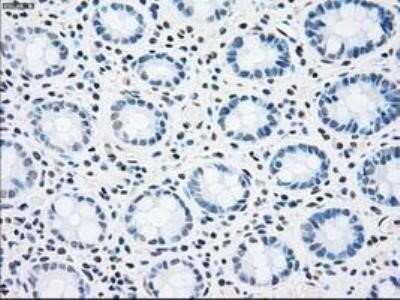 Immunohistochemistry: MST2/STK3 Antibody (OTI4G10) - Azide and BSA Free [NBP2-72794]