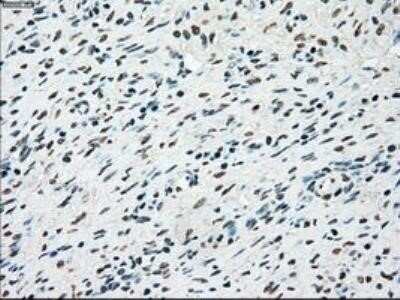 Immunohistochemistry: MST2/STK3 Antibody (OTI4G10) - Azide and BSA Free [NBP2-72794]