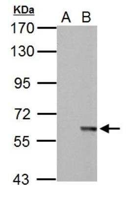 Western Blot: MST2/STK3 Antibody [NBP1-32313]
