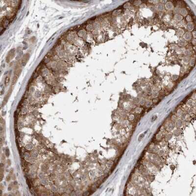 Immunohistochemistry-Paraffin: MST3 Antibody [NBP1-87833]