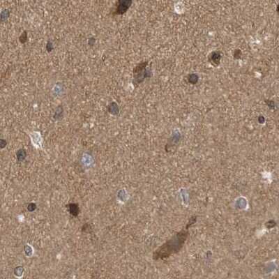 Immunohistochemistry-Paraffin: MST3 Antibody [NBP1-87834]
