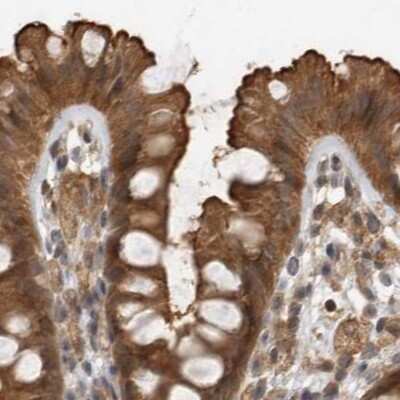 Immunohistochemistry-Paraffin: MST3 Antibody [NBP1-87834]