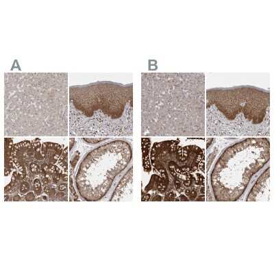 Immunohistochemistry-Paraffin: MST3 Antibody [NBP1-87834]
