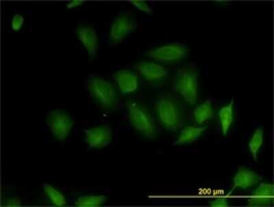 Immunocytochemistry/ Immunofluorescence: MST4 Antibody (2G6) [H00051765-M01]