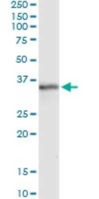 Immunoprecipitation: MSX1 Antibody (1E2) [H00004487-M11]