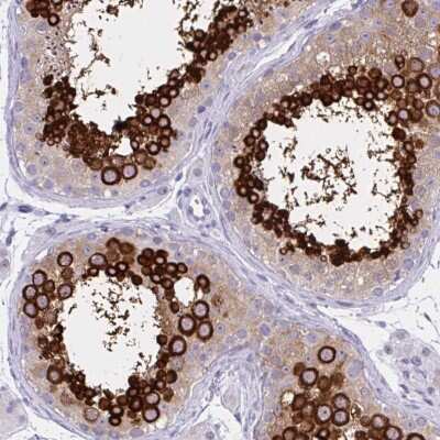 Immunohistochemistry-Paraffin: MSY2 Antibody [NBP2-33698]