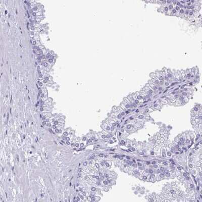 Immunohistochemistry-Paraffin: MSY2 Antibody [NBP2-33798]