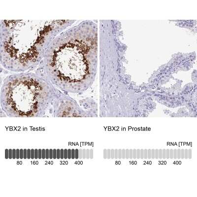 Immunohistochemistry-Paraffin: MSY2 Antibody [NBP2-33798]