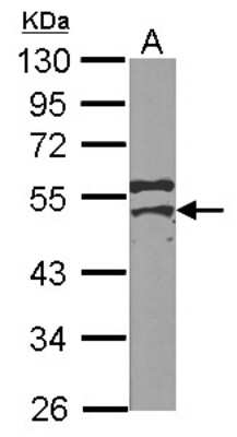 Western Blot: MSY2 Antibody [NBP2-19422]
