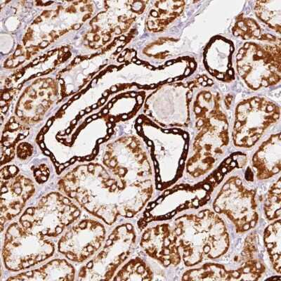 Immunohistochemistry-Paraffin: MT-CO2 Antibody [NBP2-37930]