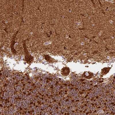 Immunohistochemistry-Paraffin: MT-CO2 Antibody [NBP2-37930]