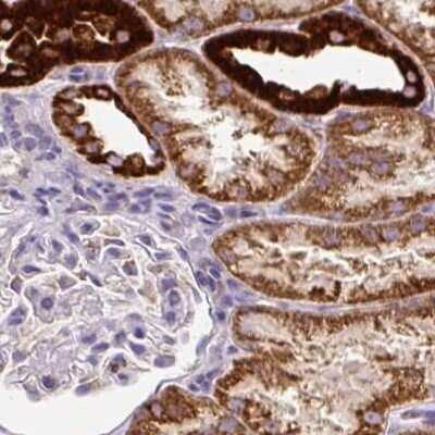 Immunohistochemistry-Paraffin: MT-CO2 Antibody [NBP2-37945]