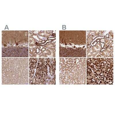 Immunohistochemistry-Paraffin: MT-CO2 Antibody [NBP2-37945]