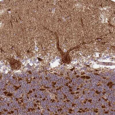 Immunohistochemistry-Paraffin: MT-CO2 Antibody [NBP2-37945]