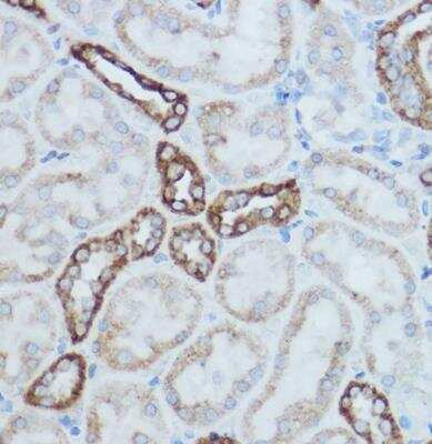 Immunohistochemistry-Paraffin: MT-CO2 Antibody - BSA Free [NBP2-94364]